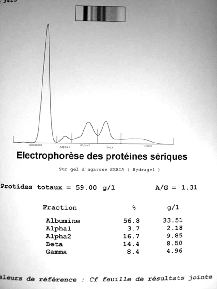 cas clinique