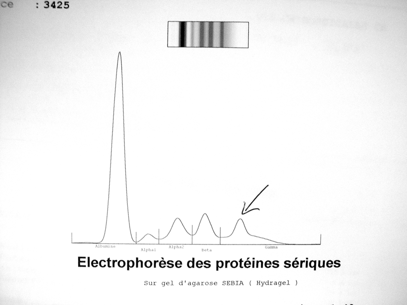 cas clinique